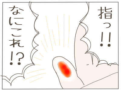 火傷6