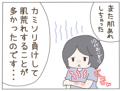 脱毛4