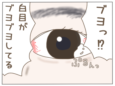 結膜浮腫３