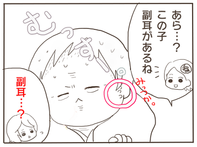 副耳１