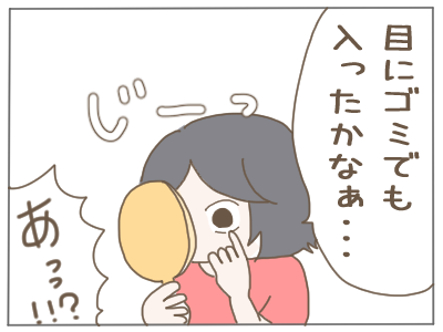 結膜浮腫２