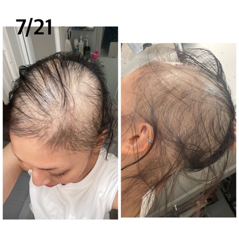 o1080108014980135763