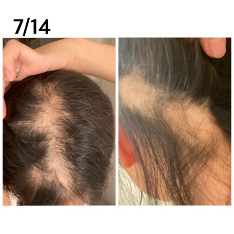 o1080108014980129859