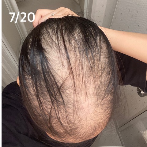 o1080108014980135758