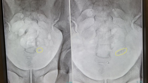 15-1105 (3)