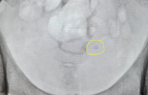15-1105 (2)