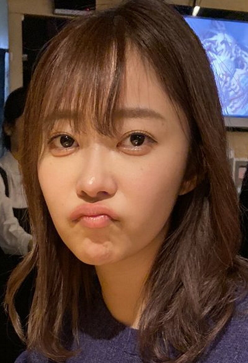 整形 整形モンスター指原莉乃 目にはなめくじ 鼻はカイジにwwwwww アイドル整形 美容まとめ