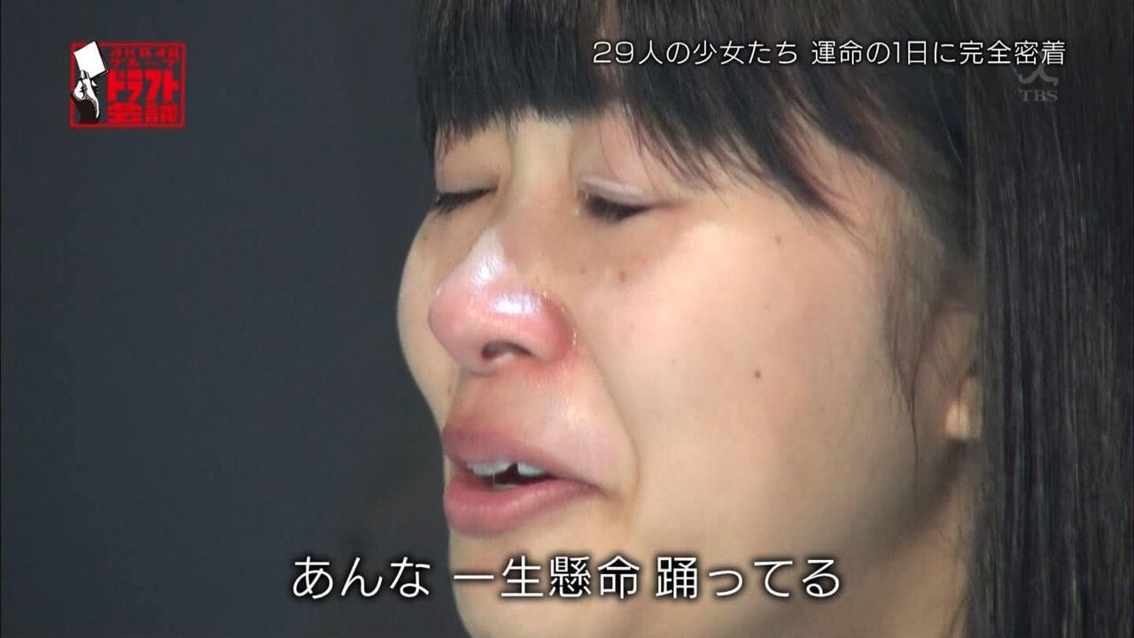 画像 整形依存性 指原莉乃 顔面崩壊のお知らせwwwwww アイドル整形 美容まとめ 画像 整形依存性 指原莉乃 顔面崩壊のお知らせwwwwww アイドル整形 美容まとめ
