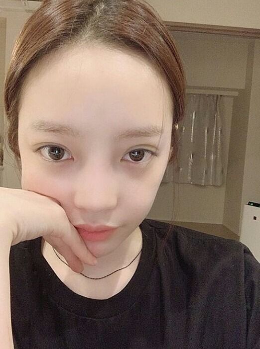 悲報 親日家のク ハラ 元kara 日本での療養は韓国の自宅がバレたため アイドル整形 美容まとめ 悲報 親日家のク ハラ 元kara 日本での療養は韓国の自宅がバレたため アイドル整形 美容まとめ
