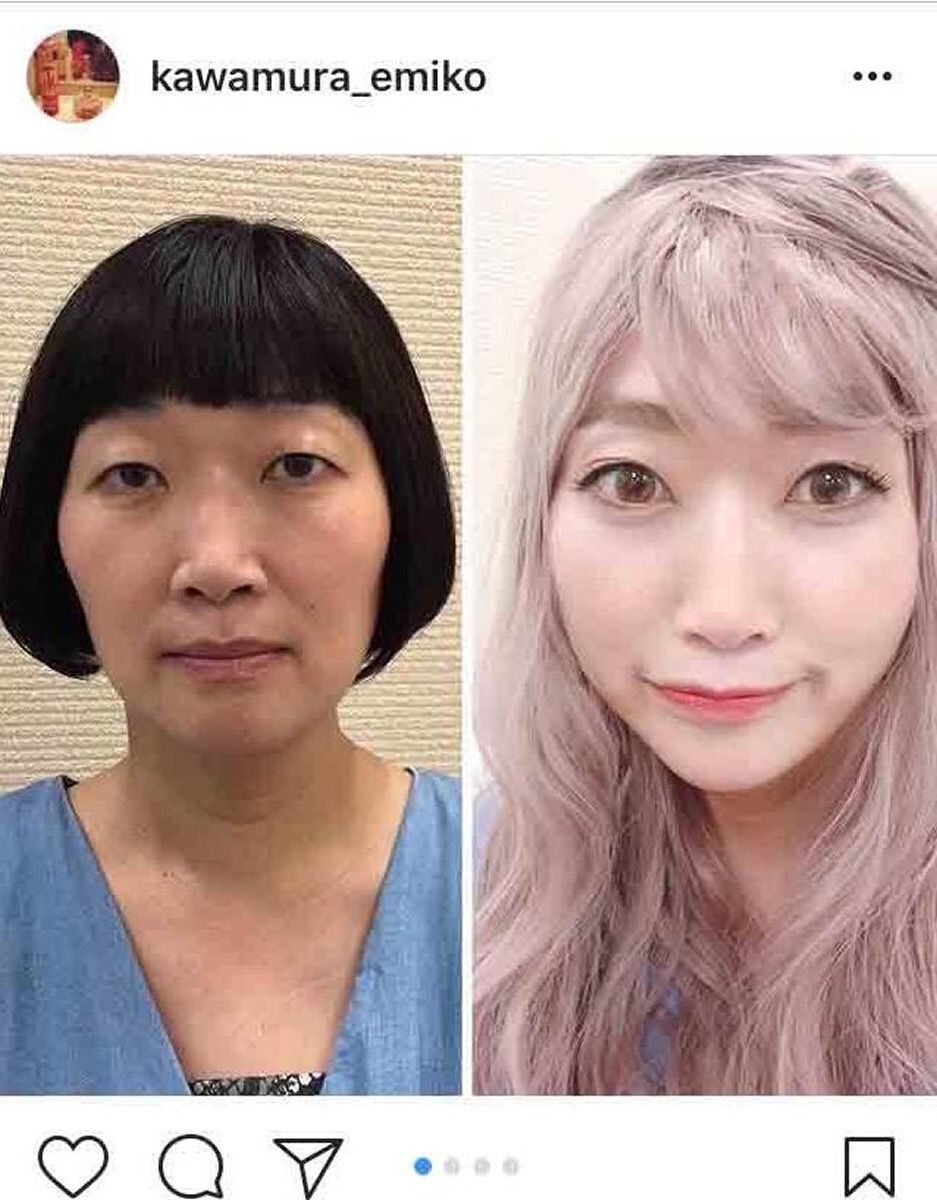 画像 整形モンスター指原莉乃 宮脇咲良に寄せて金髪にした髪が死んでる件wwwww アイドル整形 美容まとめ