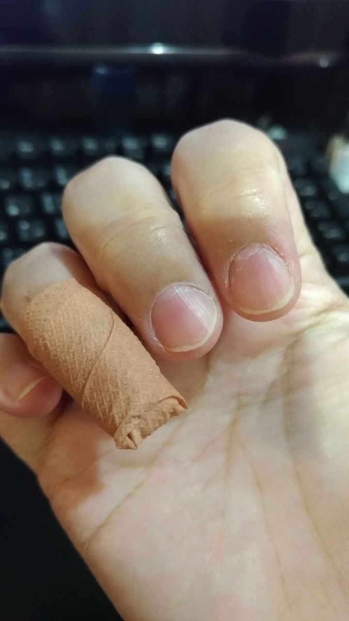 閲覧注意グロ ネイルサロン行ってみたいけど貧相な爪で躊躇してる ポンコツ母さん