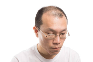 禿たくない