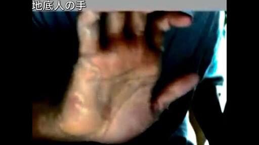 アトピーがつらいなんj民wwww 大物youtuber速報 アトピーがつらいなんj民wwww 大物youtuber速報