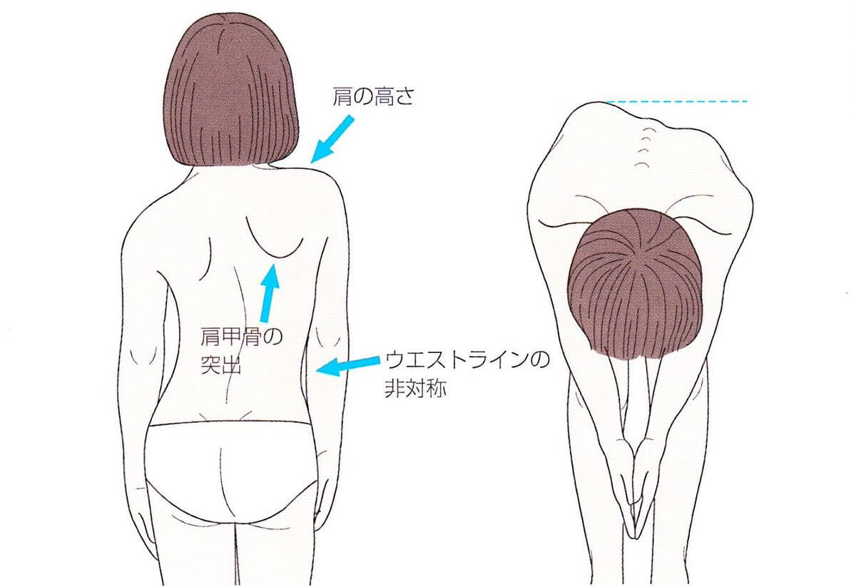 Syamuさんの体のハンディキャップが多すぎるwww 大物youtuber速報 Syamuさんの体のハンディキャップが多すぎるwww 大物youtuber速報