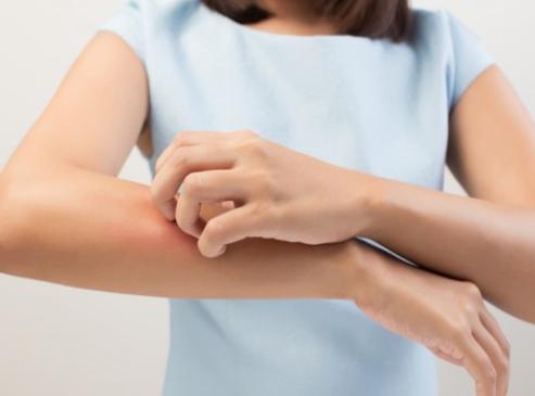 アトピーの人はなぜ増えるの 現代社会が抱える４つの問題から見える アトピー増加の原因とは