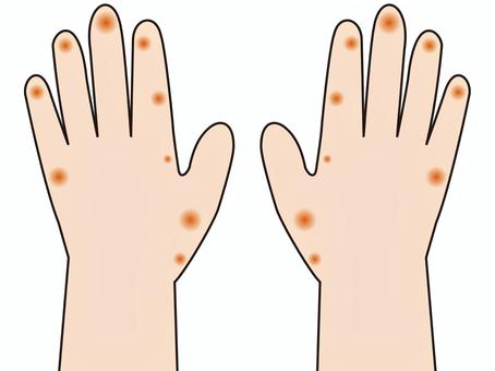 ff019d4623d8f95fd513da8e1f30100f_t