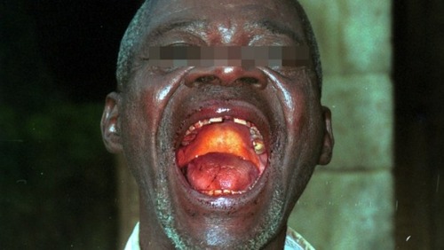 Ebola-620x350