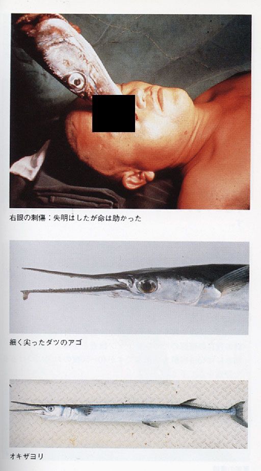 閲覧注意 釣り人少年の首に極太の ダツ が突き刺さってしまう お魚まとめ 閲覧注意 釣り人少年の首に極太の ダツ が突き刺さってしまう お魚まとめ