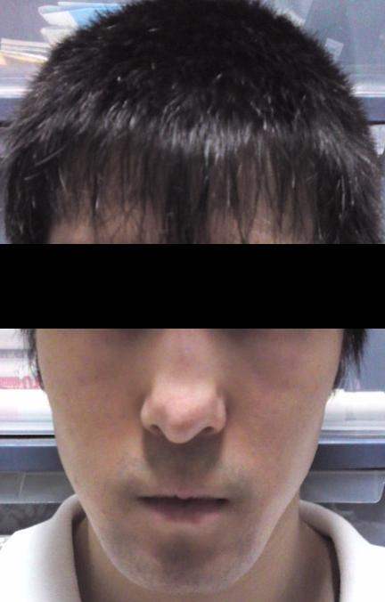 大塚美容形成外科 被害者ブログ 整形失敗 大塚美容形成外科 被害者ブログ 整形失敗