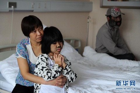 【中国】多毛症の四川の女の子、脱毛手術してイモト風の美 ...