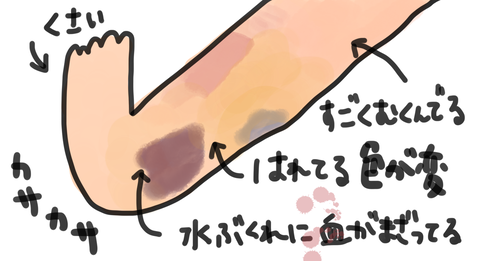 手術の内容2