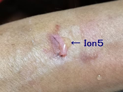 Ion�����ũ��餷��