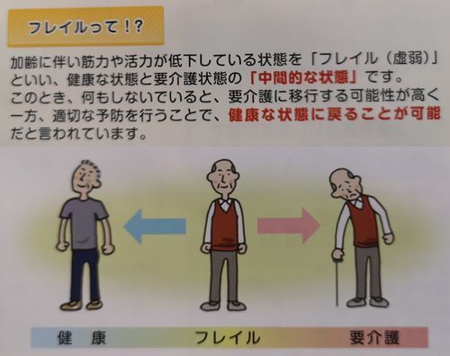 �ե쥤��γ�ǰ�Ȥ�