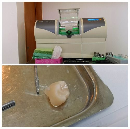 £±£°Ê¬¤¢¤Þ¤ê¤Ç½ÐÍè¾å¤¬¤ê