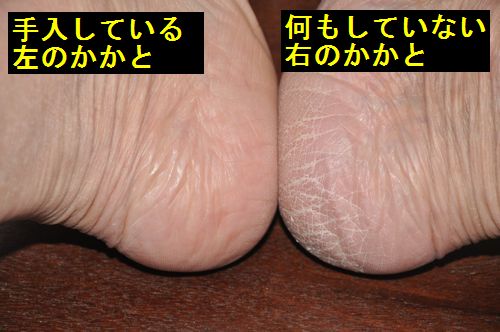 ������