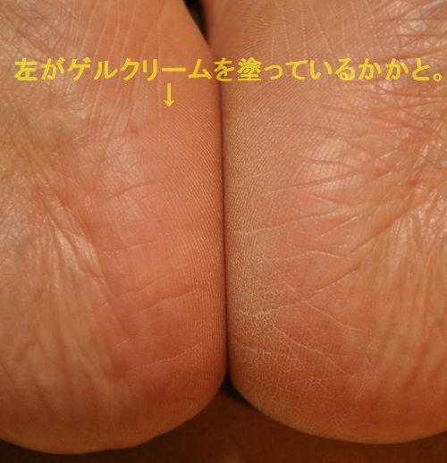 ? かかとを比較してみました。