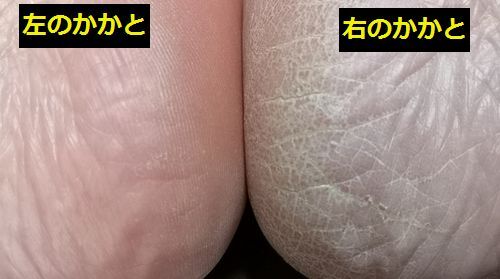 ��ǯ�����ߤΤ��ᤫ���ȤϤҤ�