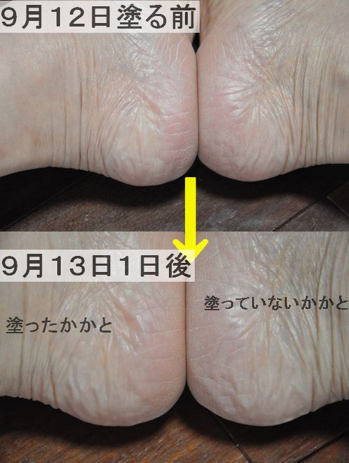 ���ڤ국ǰ�ˣ���������