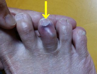 ���Ť���ĺ���ޤ���