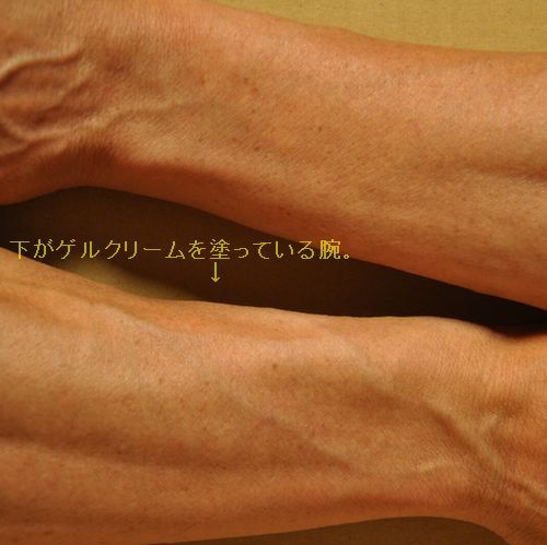 ? 写真下の右手がエバメール・ゲルクリームを塗っている腕です