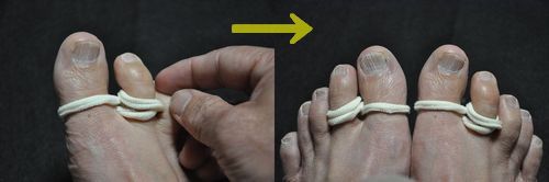 ���ξ���Ʊ�����ΤǻؤΤߤ���Ŵ����ˤ��ޤ�