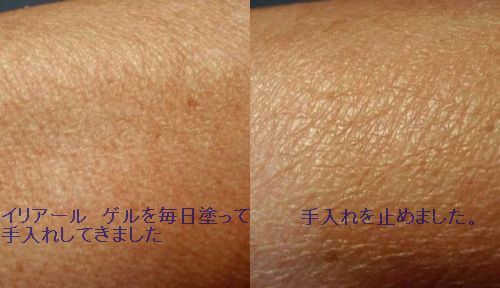 �������ꥢ���롡����⥤�������饤�������ɤ�