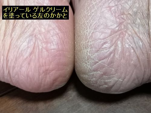 ������ǣ�����Ф��ޤ���