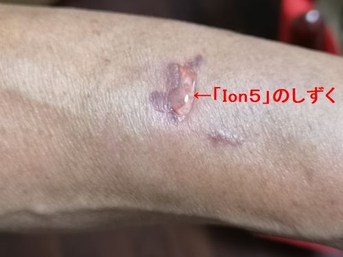 ��Ion���פ�ݥ��ݥ����