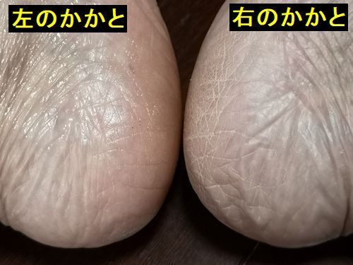 ���åץ��ɤ�ޤ���