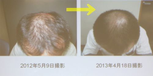 �Ӻ������֤ä��餳�����Τ褦��