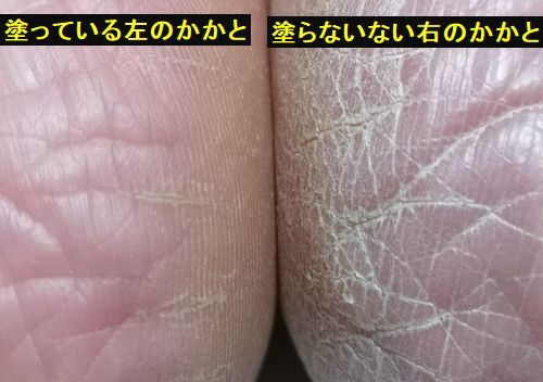 ���礹��ȡ�����