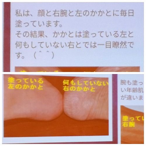 ²Ã¤«¤ÈÈæ³Ó¼Â¸³