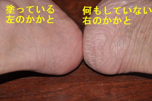 ������
