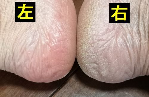 ���ȱ��Τɤ���δ餬�����Ǥ�����