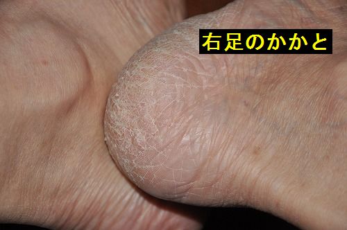 ���Τ����Ȥ���礷�Ƥߤ��