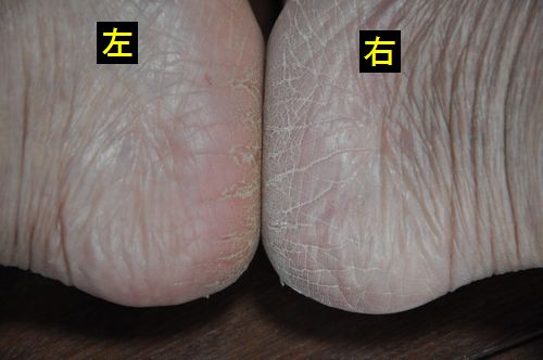 ��������Τ����ȤǤ�