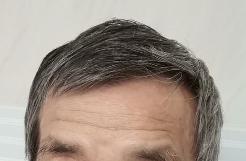 È´¤±ÌÓ¤¬·ã¸º¤·¤¿¤È¤¤¤¦¤³¤È¤Ï