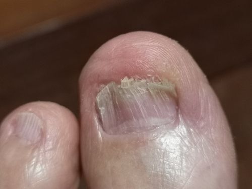 �����˿��Ӥ�ޤ�³���ޤ�