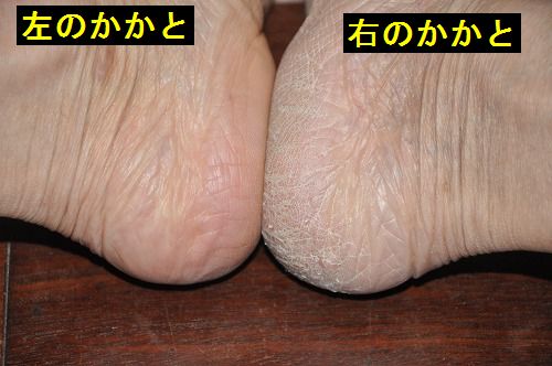 �̿�����