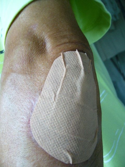 すり傷の治し方 : 還暦からの出発